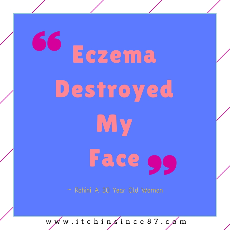 Eczema Destroyed My Face