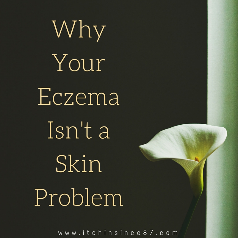Why Your Eczema Isn't a Skin Problem
