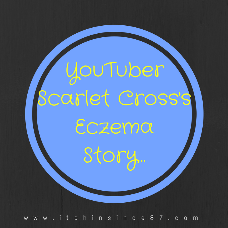 YouTuber Scarlet Cross Eczema Story…