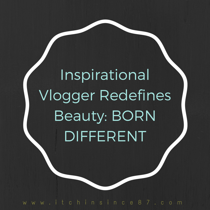 inspirational-vlogger-redefines-beauty-born-different
