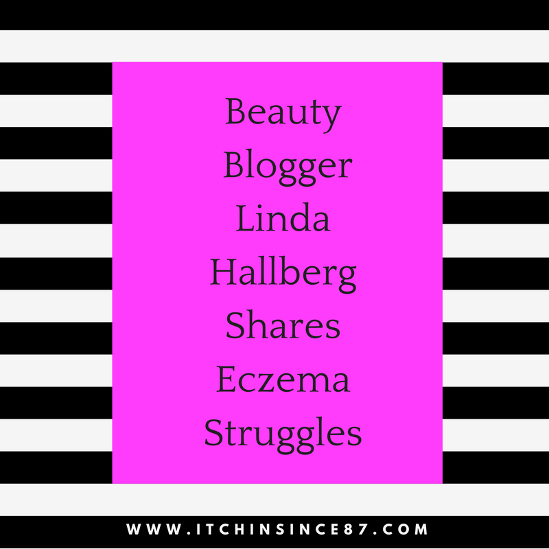 Beauty Blogger Linda Hallberg Shares Eczema Struggles