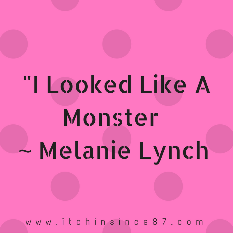 i-looked-like-a-monster-melanie-lynch