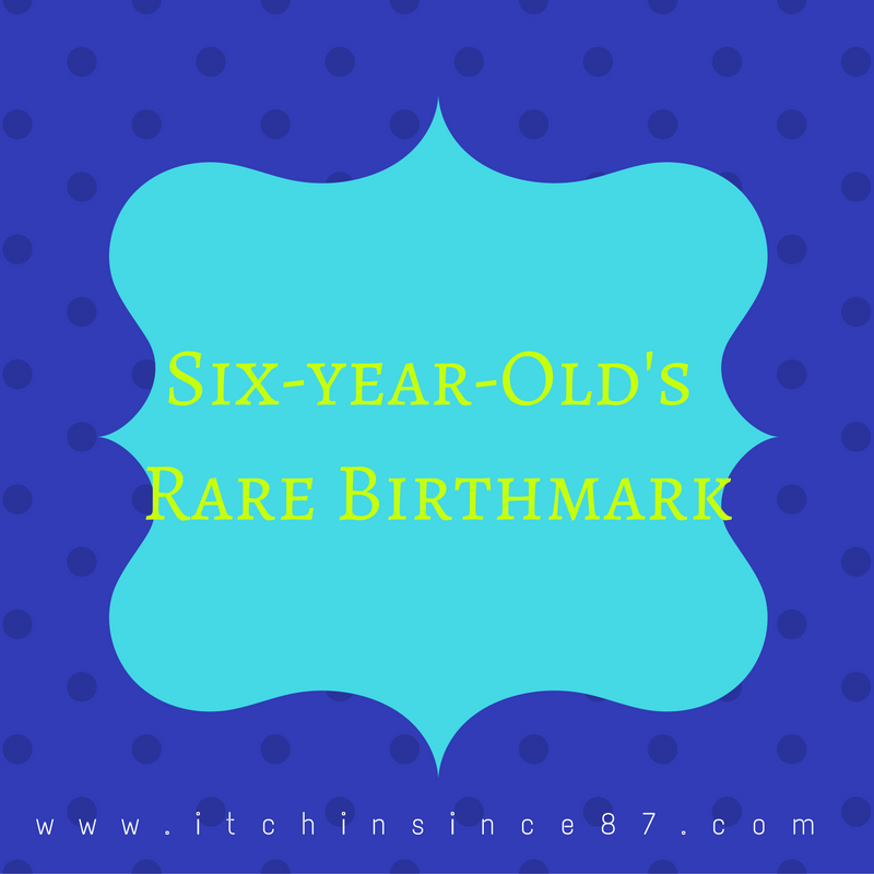 six-year-olds-rare-birthmark