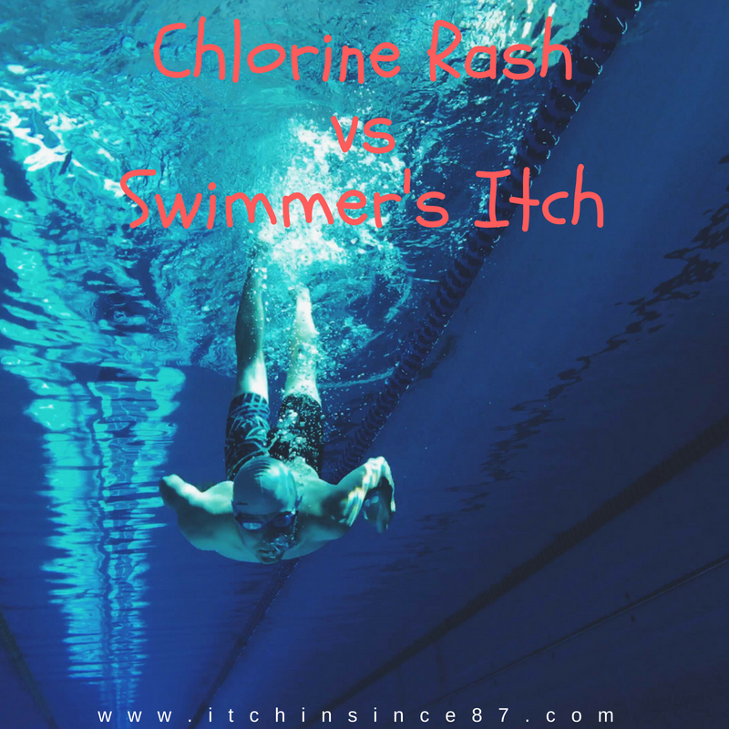 heat rash vs swimmers itch
